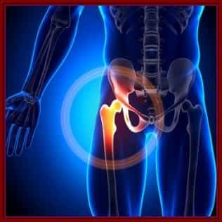 Hip Replacement Procedure